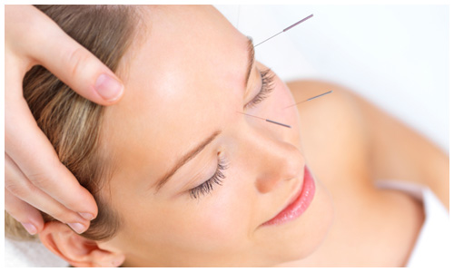 Cosmetic Needling I Natural Healing